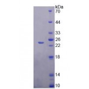 SDS-PAGE analysis of Mab21 Domain Containing Protein 1 Protein.