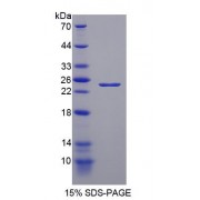 SDS-PAGE analysis of recombinant Mouse NEIL3 Protein.