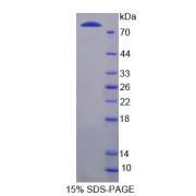 SDS-PAGE analysis of LBP Protein.