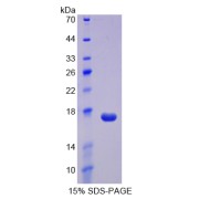 SDS-PAGE analysis of REG3A Protein.