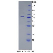 SDS-PAGE analysis of ADP Ribosylation Factor Like Protein 15 Protein.
