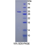 SDS-PAGE analysis of Leucine Rich Repeat Containing Protein 32 Protein.