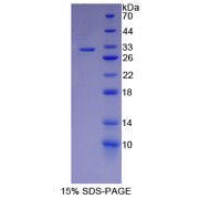 SDS-PAGE analysis of Iron ResPonsive Element Binding Protein 2 Protein.