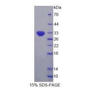 SDS-PAGE analysis of recombinant Human 2',5'-Oligoadenylate synthetase Like Protein.