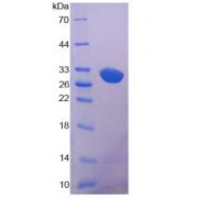 SDS-PAGE analysis of LRP5 Protein.