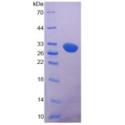 SDS-PAGE analysis of LRP5 Protein.