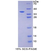 SDS-PAGE analysis of Kinase R Protein.