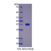 SDS-PAGE analysis of Haptoglobin Protein.