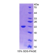 SDS-PAGE analysis of IL18 Protein.