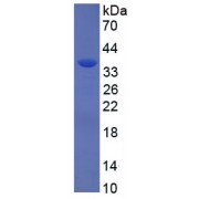 SDS-PAGE analysis of Antithrombin-III Protein.