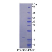 SDS-PAGE analysis of Osteocalcin Protein.