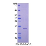 SDS-PAGE analysis of Cystatin 6 Protein.