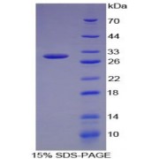 SDS-PAGE analysis of Dopamine beta Hydroxylase Protein.