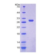 SDS-PAGE analysis of recombinant Human Thyroid Hormone Receptor beta Protein.