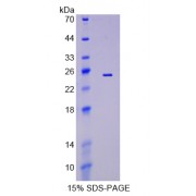 SDS-PAGE analysis of recombinant Human Ephrin A5 Protein.