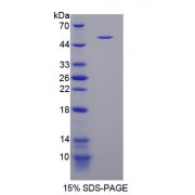 SDS-PAGE analysis of recombinant Human Retinoschisin Protein.