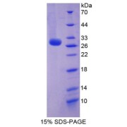 SDS-PAGE analysis of recombinant Human Reelin Protein.