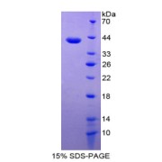 SDS-PAGE analysis of Epithelial Neutrophil Activating Peptide 78 Protein.