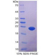 SDS-PAGE analysis of Apoptosis Associated Tyrosine Kinase Protein.