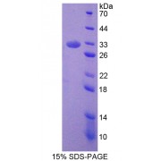 SDS-PAGE analysis of Septin 6 Protein.