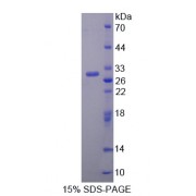 SDS-PAGE analysis of Vasorin Protein.