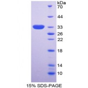 SDS-PAGE analysis of Neuronal Pentraxin II Protein.