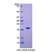 SDS-PAGE analysis of recombinant Human ADAMTS5 Protein.