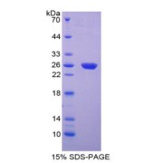 SDS-PAGE analysis of Hexokinase 2 Protein.