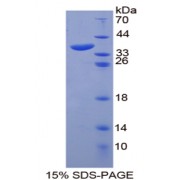 SDS-PAGE analysis of Ankyrin 1, Erythrocytic Protein.