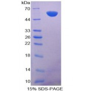 SDS-PAGE analysis of Apoptosis Antagonizing Transcription Factor Protein.