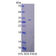SDS-PAGE analysis of Deltex Homolog 1 Protein.