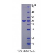 SDS-PAGE analysis of Nuclear Factor Of Activated T-Cells, Cytoplasmic 2 Protein.
