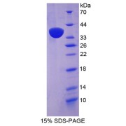 SDS-PAGE analysis of Nesprin 2 Protein.