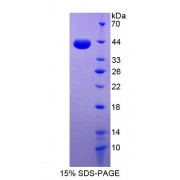 SDS-PAGE analysis of recombinant Human Desmocollin 2 Protein.