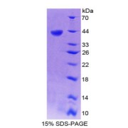SDS-PAGE analysis of recombinant Human CXCL14 Protein.