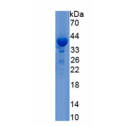 SDS-PAGE analysis of recombinant Human Inter alpha Globulin Inhibitor H1 (ITIH1) Protein.