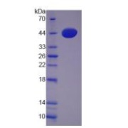 SDS-PAGE analysis of Phospholipase D Protein.