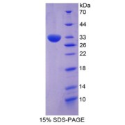 SDS-PAGE analysis of Paxillin Protein.