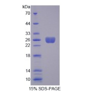 SDS-PAGE analysis of Transgelin Protein.