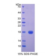 SDS-PAGE analysis of Cystatin 5 Protein.