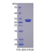 SDS-PAGE analysis of SCNN1G Protein.