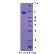 SDS-PAGE analysis of Nuclear Receptor Coactivator 3 Protein.