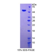 SDS-PAGE analysis of Destrin Protein.
