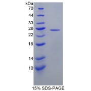 SDS-PAGE analysis of O-6-Methylguanine DNA Methyltransferase Protein.