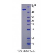 SDS-PAGE analysis of Nuclear Transcription Factor Y gamma Protein.