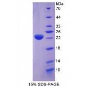 SDS-PAGE analysis of Stress Induced Phosphoprotein 1 Protein.