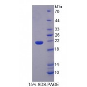 SDS-PAGE analysis of recombinant Human IL36A/IL1E Protein.