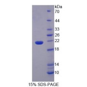 SDS-PAGE analysis of recombinant Human IL36A/IL1E Protein.