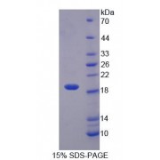SDS-PAGE analysis of IL1Q Protein.
