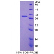 SDS-PAGE analysis of Nucleoporin 155 kDa Protein.